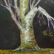 broken limb
